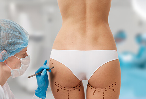 Buttocks Augmentation